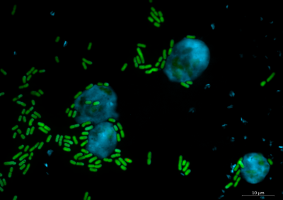 Microscopy image of amoeba and Pseudomonas